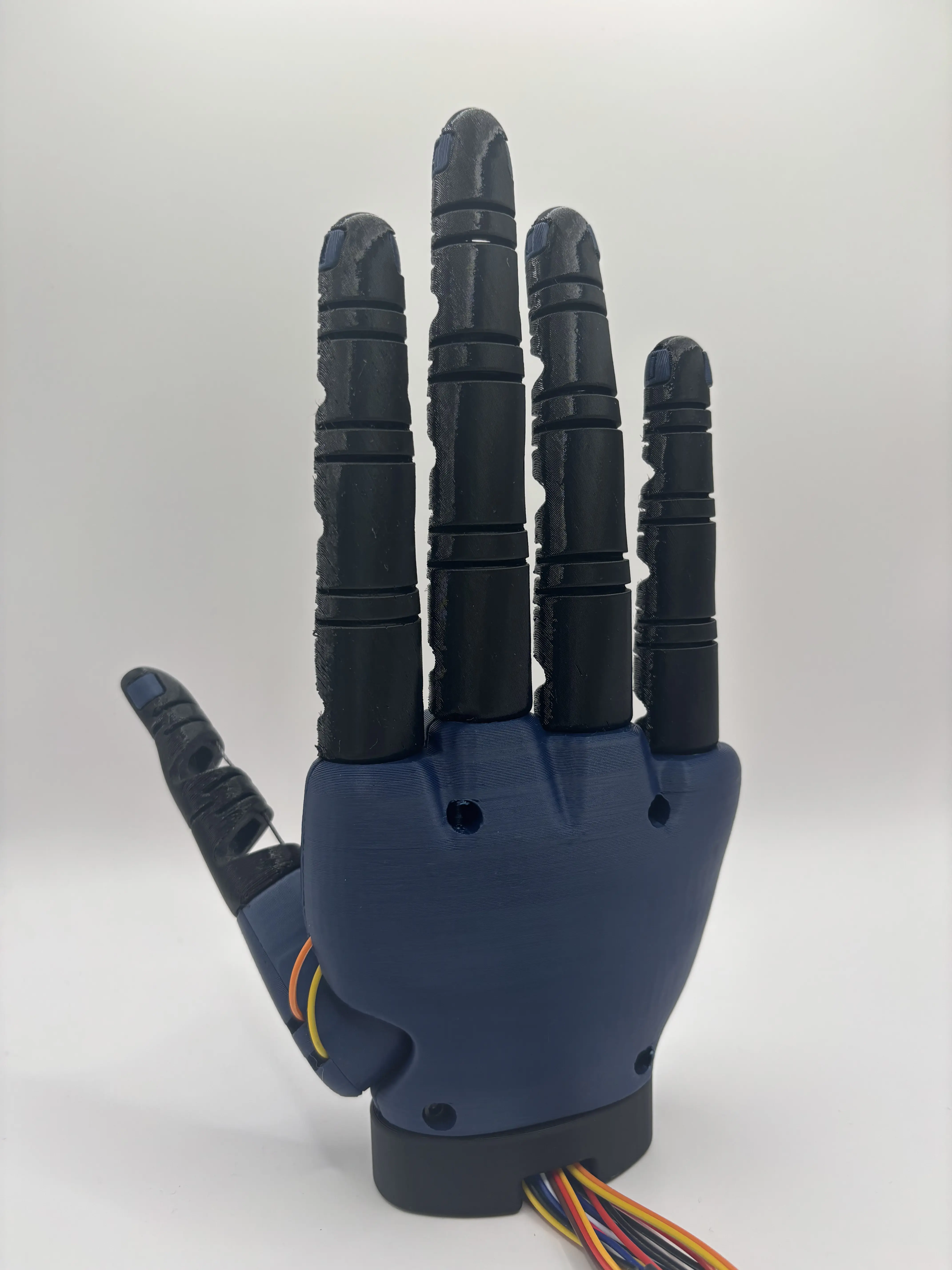 Prosthetic hand — front view